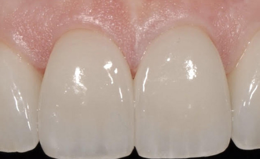 elegant-teeth-2